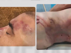 Появились фото мужчины, убитого в ТЦК в Одесской области – на них видны следы избиения