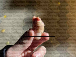 В Одессе 14-летний фигурист остался без пальца, врачи не хотели ему помогать