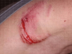 В Одесской области военный избил и покусал 14-летнего подростка