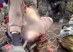 Застрявшему в мотоблоке одесситу пришлось ампутировать ногу