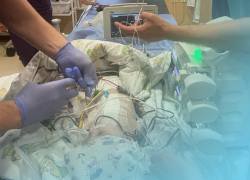 Одесские врачи имплантировали кардиостимулятор годовалому ребенку