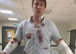 38-летний одессит порезал себя, чтобы сбежать из ТЦК