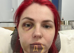 В Одессе ДТП с пострадавшими оформили как обычное нарушение