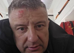 Одесские военкомы жесткого избили мужчину и бросили его на дороге