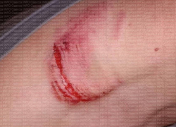 В Одесской области военный избил и покусал 14-летнего подростка