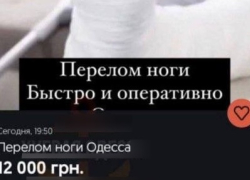 В Одессе предлагают сломать ногу за 12 тысяч гривен ради отсрочки от мобилизации