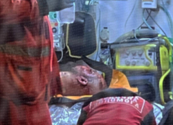 В Одессе мужчина подорвал три гранаты в жилом доме