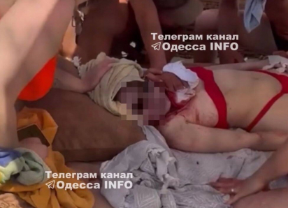 Осколок сбитого БПЛА убил девушку на одесском пляже