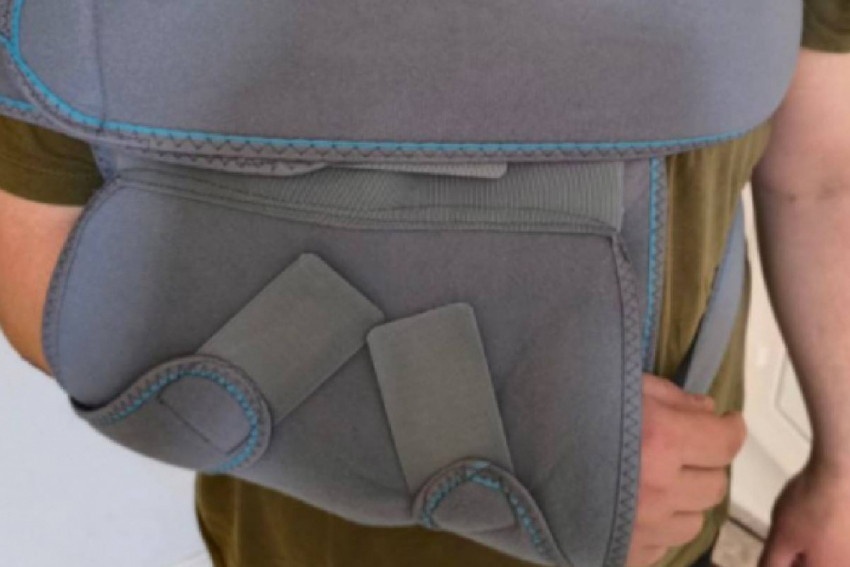 В Одессе военкомы заявили, что мобилизованный сам сломал себе ключицу и пришел в ТЦК