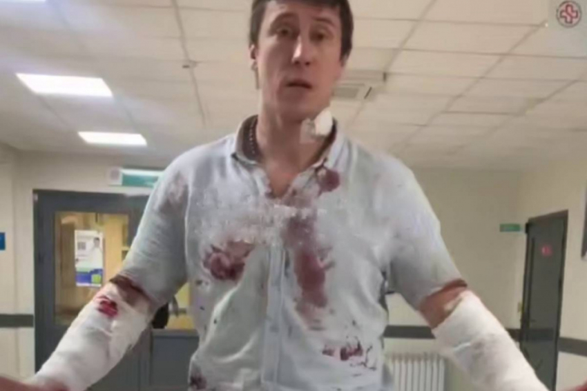 38-летний одессит порезал себя, чтобы сбежать из ТЦК