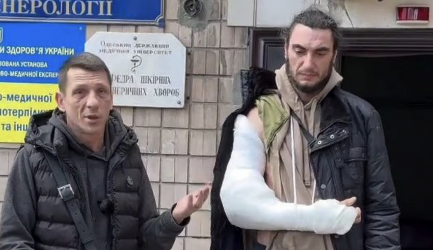 В Одессе ТЦК мобилизовали ветерана с инвалидностью и сломали ему руку