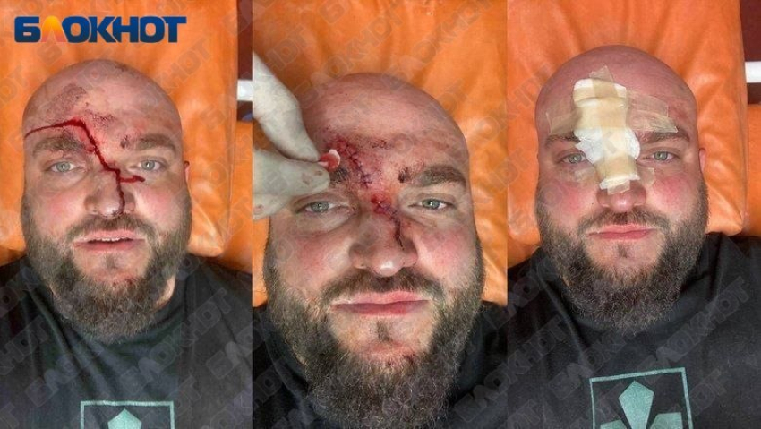 В Одесской Затоке бойца ВСУ избили арматурой за требование выключить русскую музыку