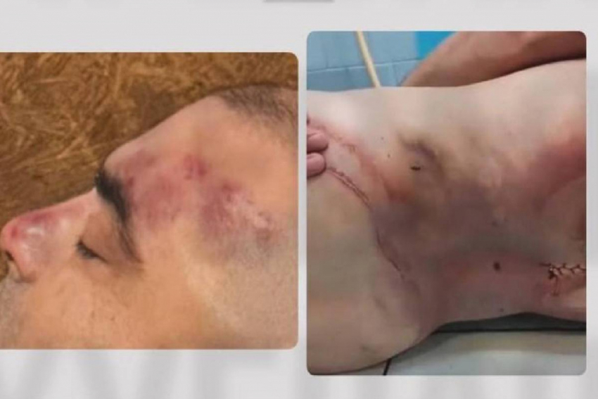 Появились фото мужчины, убитого в ТЦК в Одесской области – на них видны следы избиения