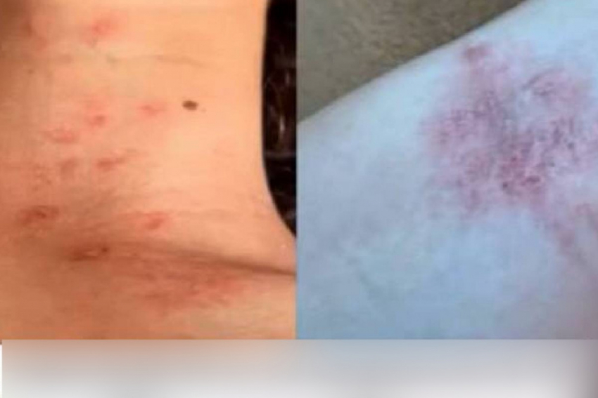 В Одессе неизвестный облил двух девочек кислотой